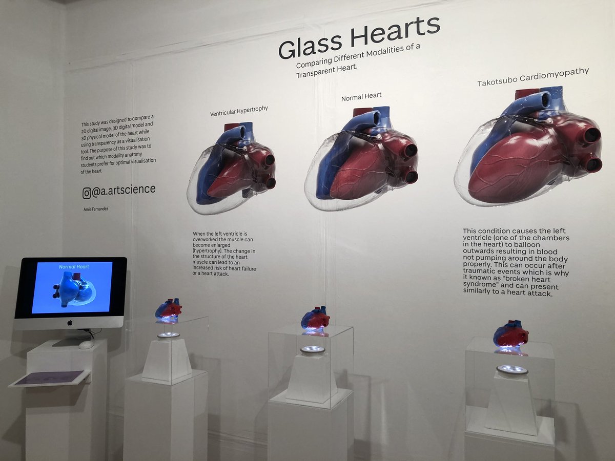 CarolineErolin's tweet image. Like this display by Amie Fernandez ‘Glass Hearts’ investigating the role of transparency in anaomical Visualisation #djcadmastersshow #sciart #medicalillustration