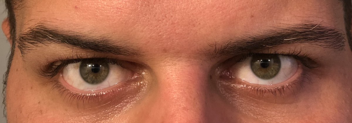 Chris_Martin70's tweet photo. They are blonde I swear.. stupid camera flash.. just let me stay young forever!! #NeverGrey #JustaTouch #Maybe @UCFSportsInfo https://t.co/8BINUttEJZ