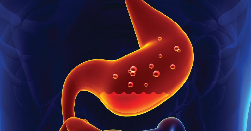 Gastritis can be easily treated with OTC antacid, but if you don't do anything about it, it can