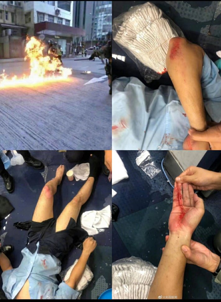 ALSA83137833's tweet photo. @thebaddest777 @sdnorton But the fact that the mob attacked the police video can you see that？the western media only play blind, only speak against the police https://t.co/zZGHC4XHzR