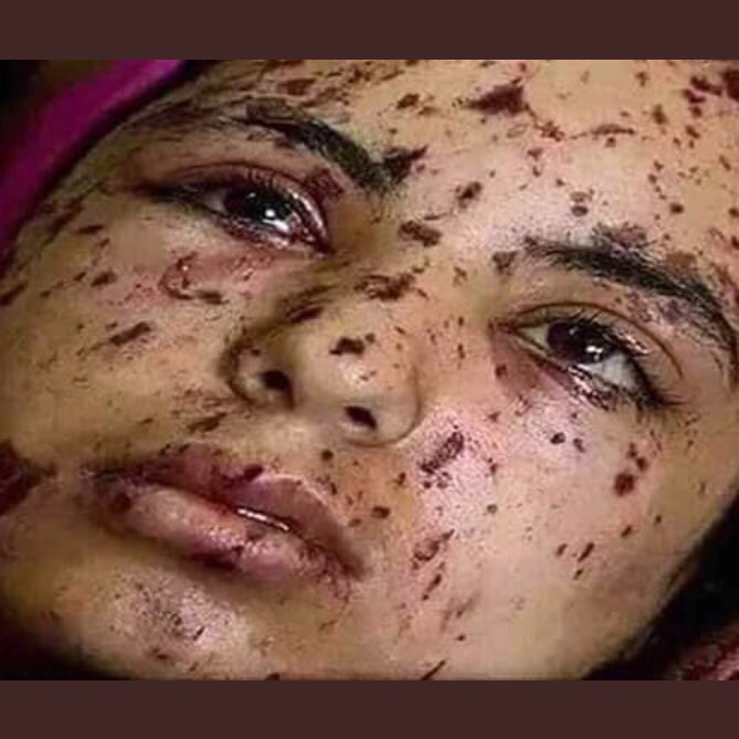sarah_s2000's tweet photo. حسبي الله ونعم الوكيل💔 #معاناه_المسلمين_بالهند https://t.co/aGC2kXyxJb
