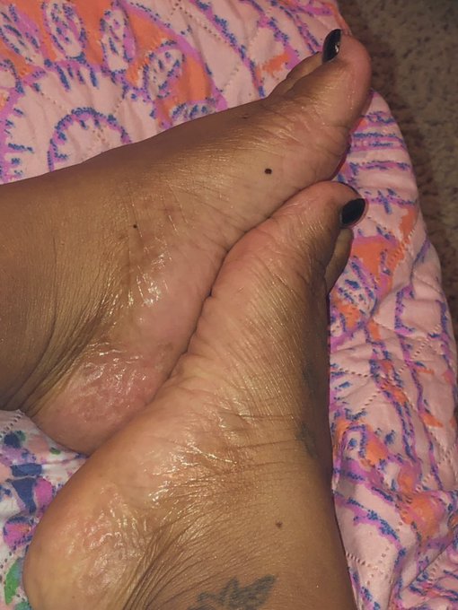 @KCFootlover Cute Chocolate Toes https://t.co/vDipfzi7fQ<a class="tags" target="_blank" title="On Twitter" href="/?out=eyJ0eXAiOiJKV1QiLCJhbGciOiJIUzUxMiJ9.eyJpYXQiOjE3MjYwNTYwMjcsImlzcyI6InR3cG9ybnN0YXJzLmNvbSIsIm5iZiI6MTcyNjA1NjAyNywiZXhwIjoxNzU3NTkyMDI3LCJyZWRpcmVjdF91cmwiOiJodHRwczovL3R3aXR0ZXIuY29tL0tDRm9vdGxvdmVyIn0.U7NjmauLcthE4ql4Nlp115w16p-dABeHXuml1uKOO9_KmVikFBFTVECTQIGcPIzVJSOIYu_TG5jky9g90oeH2g">@KCFootlover</a><a href="/tag/footfetish"class="tags"><span>#footfetish</span></a><a href="/tag/feet"class="tags"><span>#feet</span></a><a href="/tag/foot"class="tags"><span>#foot</span></a><a href="/tag/paypig"class="tags"><span>#paypig</span></a><a href="/tag/ebonysoles"class="tags"><span>#ebonysoles</span></a><a href="/tag/bbwfeet"class="tags"><span>#bbwfeet</span></a>