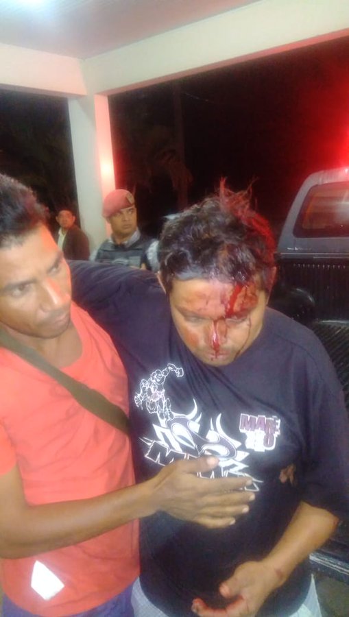 ReporteYa's tweet image. #17Ago #Frontera La situación en #Pacaraima, #Brasil, contra los venezolanos estuvo fuerte la madrugada de este sábado. Militares desalojaron a todos de las calle y los enviaron a la frontera. - @fertineo