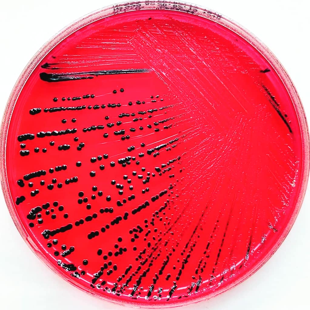 Microbio On Twitter Salmonella Enterica Serovar Enteritidis Atcc 13076 On Xld Agar Salmonella Microbiology Bacteriology Microbiologia Https T Co Fmilnhhjq6