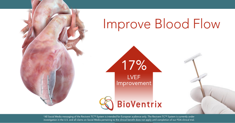 BioVentrixNL's tweet photo. Verbetering van de bloedcirculatie door je hele lichaam, komt alle organen ten goede. Lees meer over hoe het  Revivent TC™ systeem de bloedsomloop voor hartfalen patiënten kan verbeteren op https://t.co/0XYIvWR1VL. #ReviventTC #hartfalen https://t.co/pahtp2EtkX