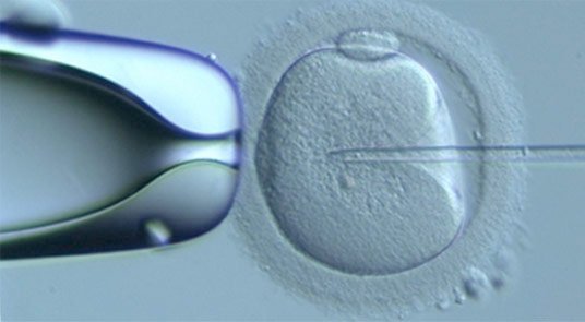 InsideIvf's tweet photo. Don't be fooled by ICSI. There is no denying it is a fantastic advancement for men with poor quality sperm, but it doesn't increase fertilisation rates for couples with normal sperm parameters #IVF #ICSI #fertility #infertility https://t.co/Dxp9leJOjS