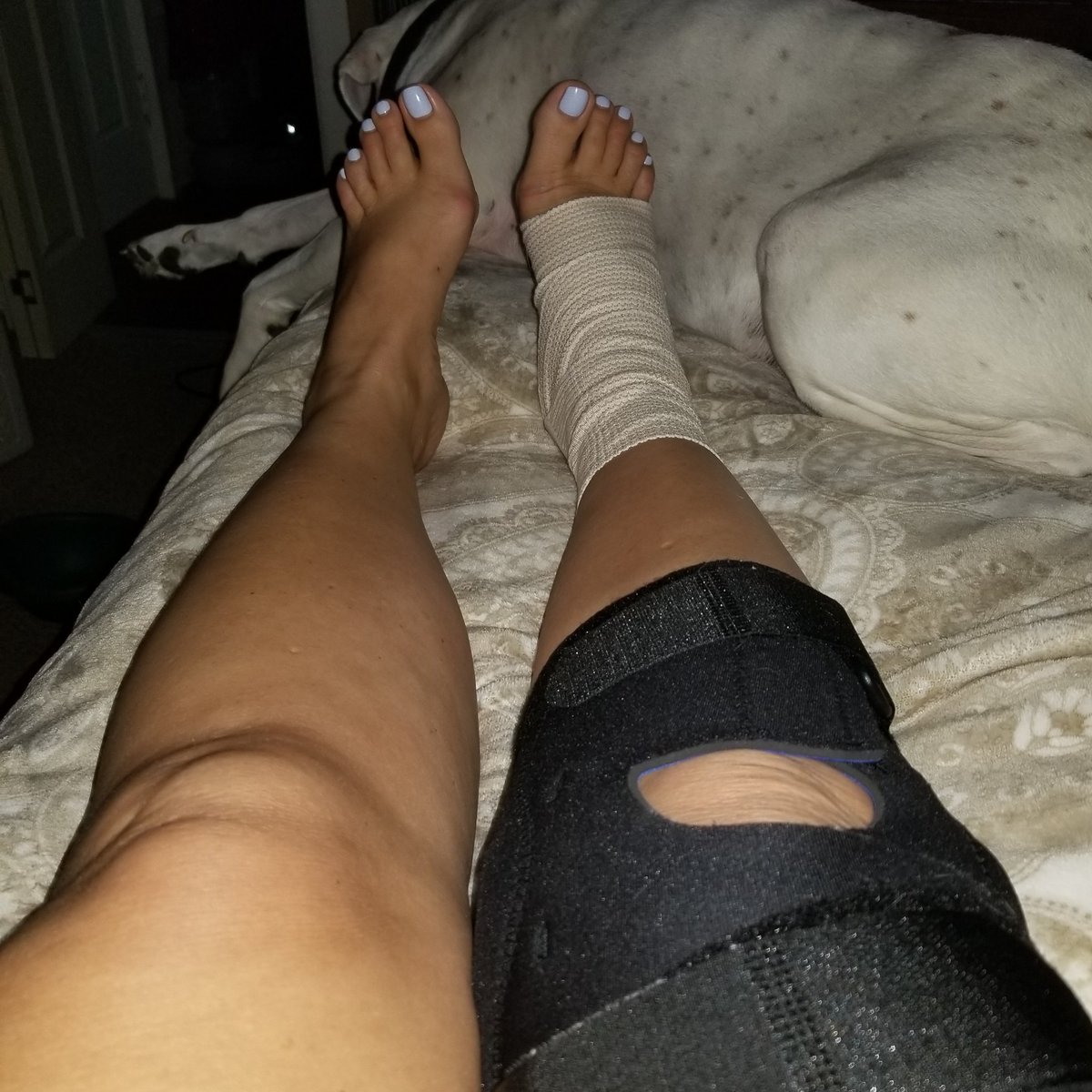 At least my toes look great! #valentinedidit #3fractures #lovemyfurbabies #bedrestsucks