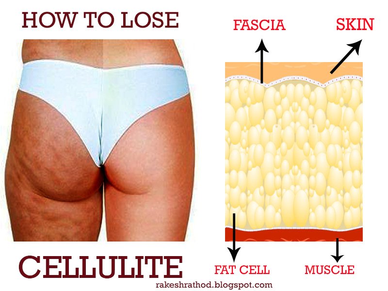 6 Simple Techniques For Guide To Cellulite Reducing Foods - Realbuzz.com thumbnail