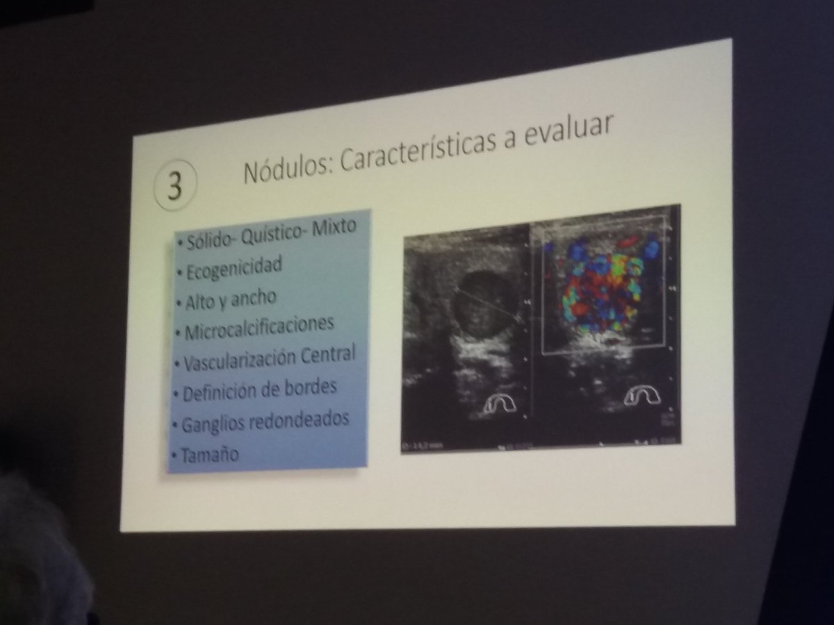 magraziagirone's tweet photo. Dr Builes de @ENDOCRINO_COL en #ACMI2019 #Nodulotiroideo #nodulo en #tiroides #thyroid #ecografia #intervenir o simplemente #observar ???? @Acmi60 @kokecorsol @jokin510 @krenanaya @FREDDYMEN2014 @RGomezHuelgas @yulnunezvill @jr_sarmientoc @drfherediaz https://t.co/4nqfqFqEjB