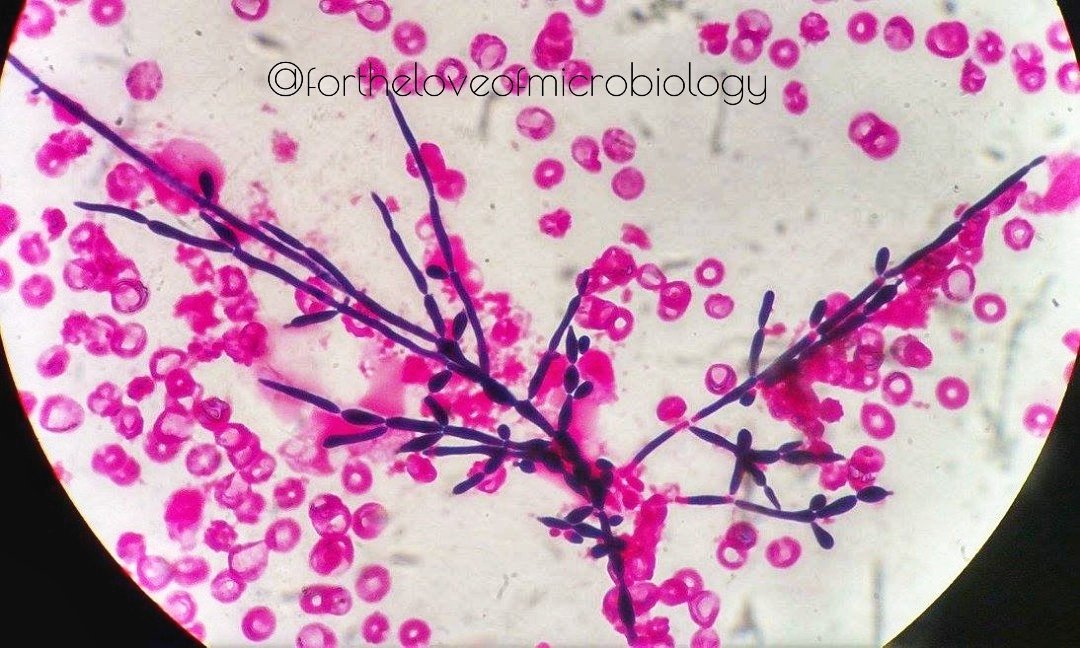 budding yeast gram stain