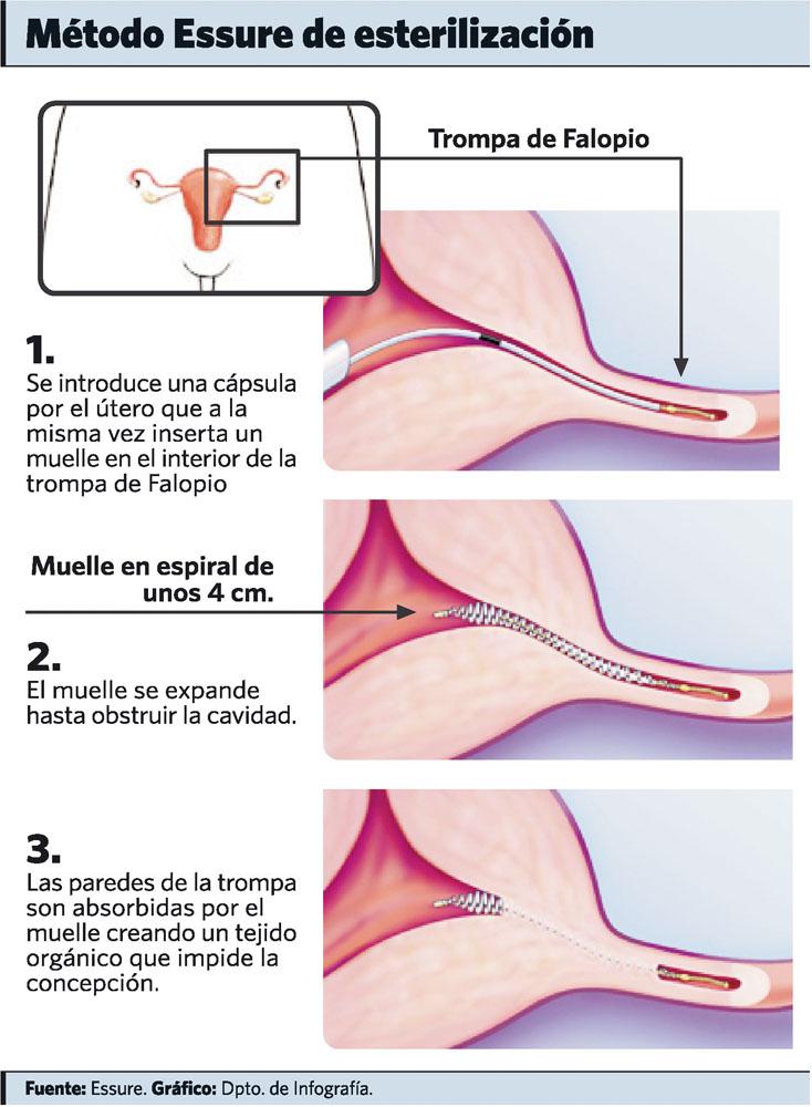 doctorneyro's tweet photo. En el mundo de a #anticoncepción no todo han sido #exitos para la #mujer.

A veces, lo peor de cometer un #error es el empecinamiento de su mantenimiento en el #tiempo.

Ello solo contribuye a incrementar el #daño.

Lecciones de la #vida.

https://t.co/dx2EaUKzuX https://t.co/VuSDOuDw7z