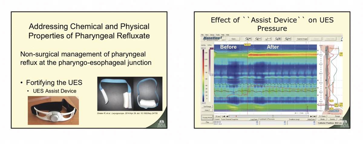 WalterChanMD's tweet photo. Great lecture by Dr. Reza Shaker from @MedicalCollege on upper esophageal sphincter (UES) physiology and dysfunction. The UES Assistive Device is a non-invasive instrument that helps augment UES pressure and has been shown to reduce pharyngeal #reflux &amp; #LPR symptoms. #ANMS2019 https://t.co/W5Zk1f1BFz