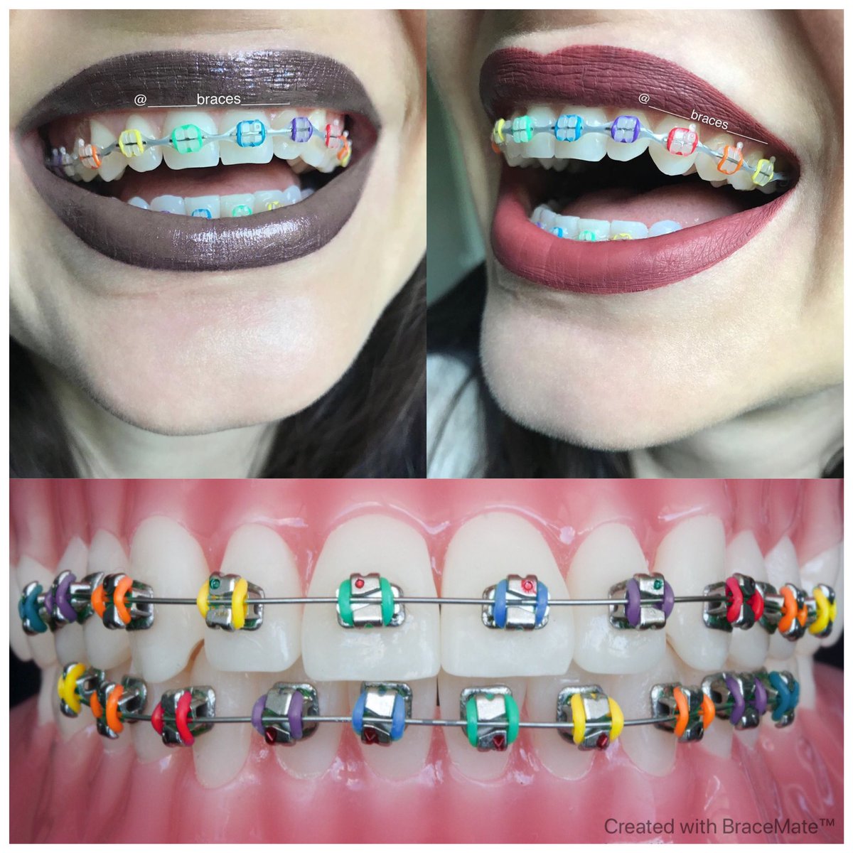 BraceMateApp's tweet photo. Today’s featured braces colour design is by @______braces______ on insta
#color #braces #braceface #ceramics #dental #ortodontia #orthodontics #dentist #dentistry #odontologia #dentista #mouth #orthodontics #orthodontist #lips #lipstick #braceson #bracesprogress #bracesproblems https://t.co/QMHM8HK958