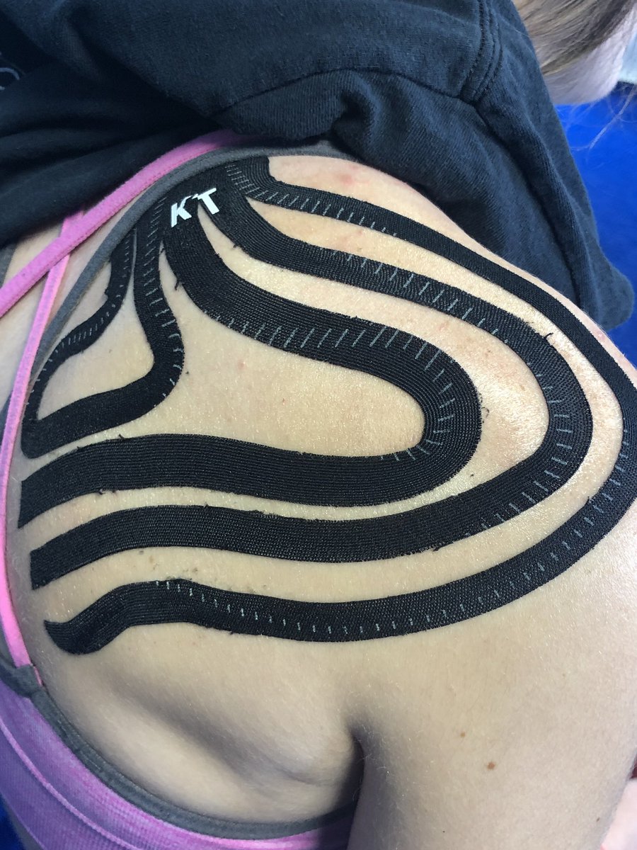 Shoulder Therapy With Hannah Maclean (Grand Canyon). #ShoulderRecovery #KtTape #TrustTheProcess @MikeEliteAthle1 @KTTape