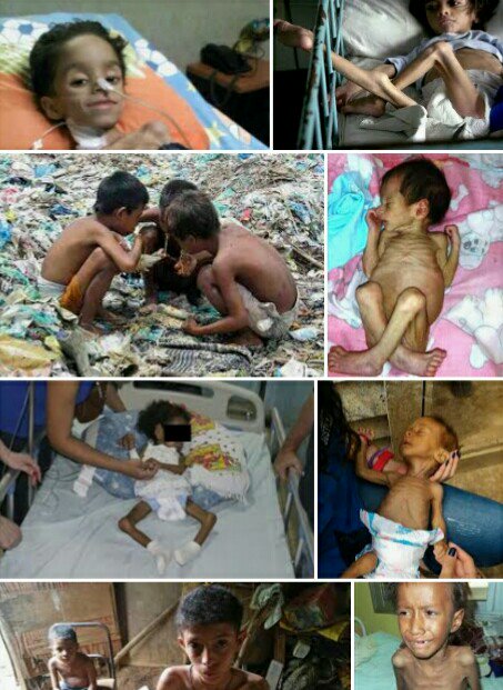 Mayra08430194's tweet photo. @hermanntertsch @Julia_del_Rey1 El dinero en la basura los niños muriendo de hambre y faltos de medicamentos y medios en los hospitales. Socialismo hambre y miseria. https://t.co/e214iwglen
