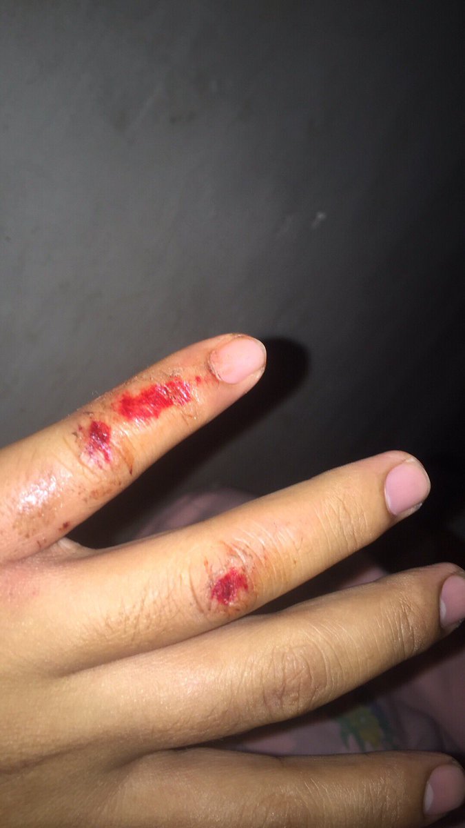 Nieelsanity's tweet photo. Tocino by yours truly 😅 https://t.co/XGbIUsi1K5