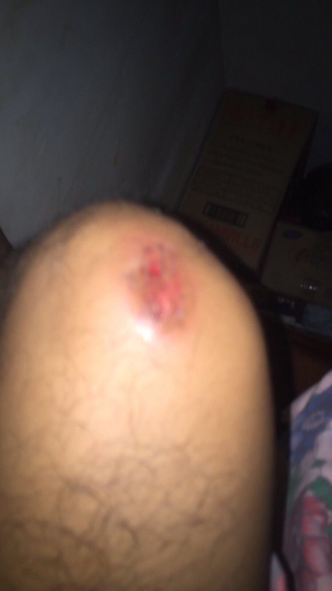 Nieelsanity's tweet photo. Tocino by yours truly 😅 https://t.co/XGbIUsi1K5