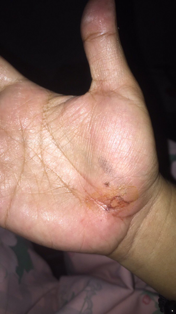 Nieelsanity's tweet photo. Tocino by yours truly 😅 https://t.co/XGbIUsi1K5
