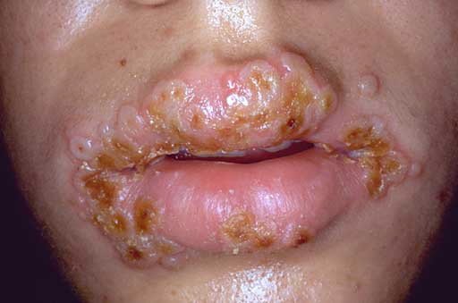 masterofmetal's tweet photo. your Mother's Murky Mound Mucus is quite Corrosive~ it left a Red Rash around Mortimer's Mealy Mouth &amp; gave him a Caustic Case of Hoof &amp; Mouth disease. Plus, #yourmother has Trenchmouth. Of the Vagina. Next time, give the ol' Bidet a Serious Squat &amp; flush out those Putrid Pipes! https://t.co/a2IqKcVsdF