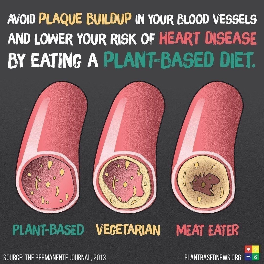 Plant Based News on Twitter "Your arteries on a plantbased diet 🌱