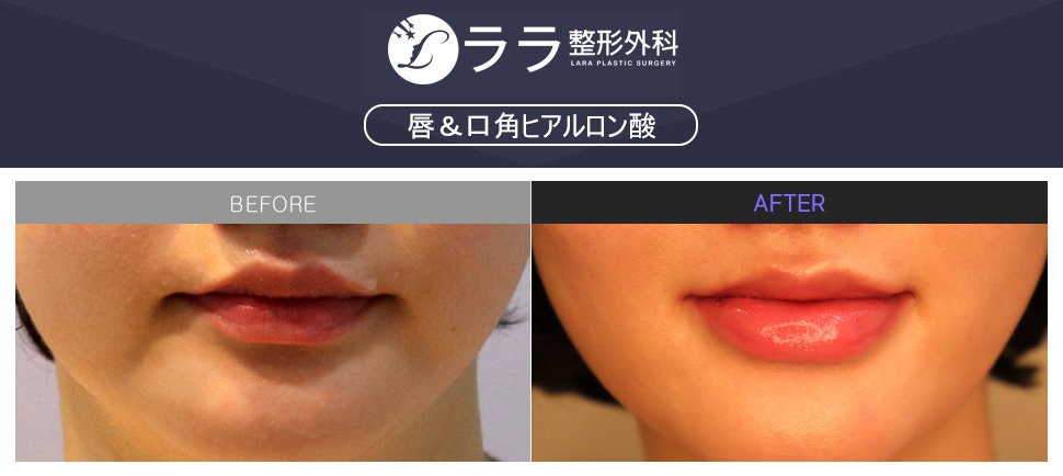 唇整形 Twitter Search