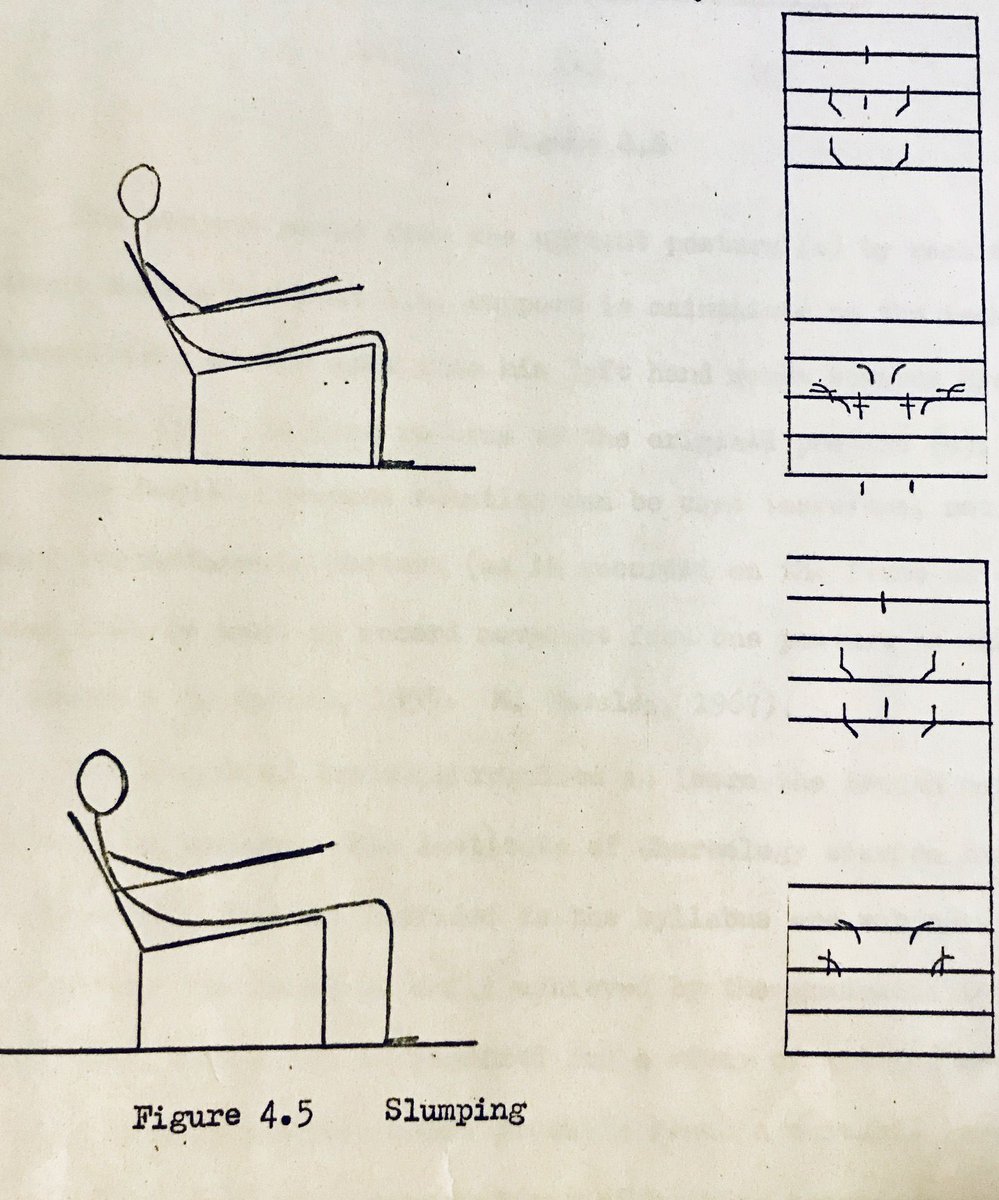 RADheadquarters's tweet photo. Commonly used in the recording of dance choreography, #Benesh Movement Notation can be applied to record any type of human movement, including slumping in chairs. Contribute to Benesh Congress 2020 > https://t.co/45MP41BUOT https://t.co/lLpbj4AcM2