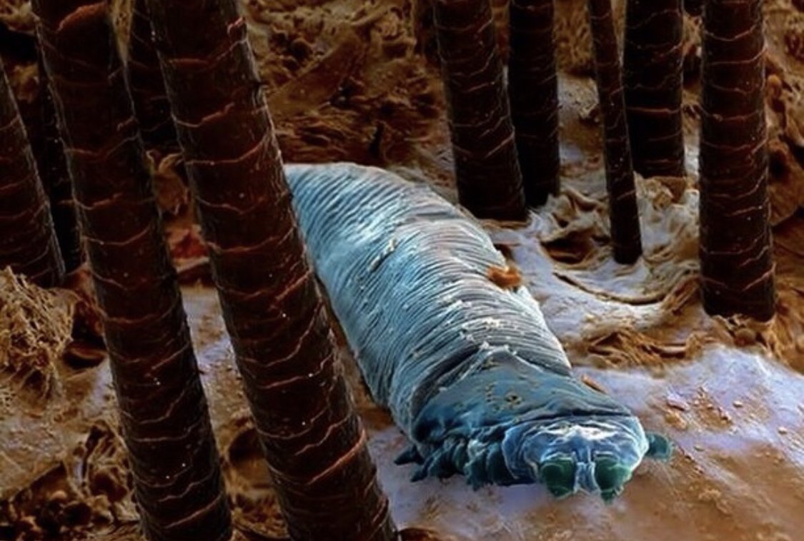 ácaros microscópicos