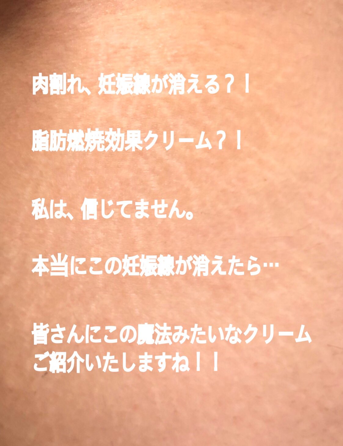 ネイルサロン Annie Gino 妊娠線が消える なんて聞いたことがない 本当に消えるのか今日から検証スタート 消えたら皆さんにご紹介いたしますね 妊娠線 肉割れ 脂肪燃焼 脂肪分解 魔法のクリーム 本当なら即爆買い 検証 信じない