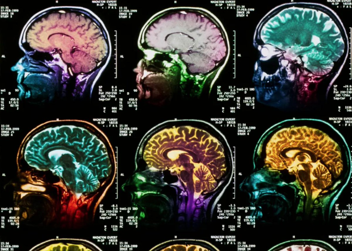 THINKERSbrain's tweet image. Movement, like running, has tremendous benefit...we THINK!   zcu.io/hahS #ThinkCreateShare #ExperiencesForEvents #RockYourSoulatIMEX