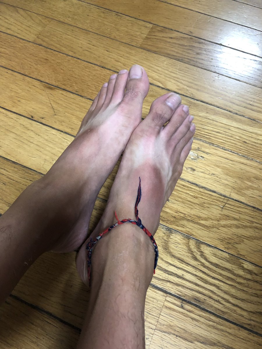 ℹ Hiroyuki 稲永泰之 日焼けで真っ黒 仕事場の人からサーフィン始めたんか って いや釣りです 好きすぎだろ いや大好きです と答えてきたw 来年からは日焼け止め塗ります W