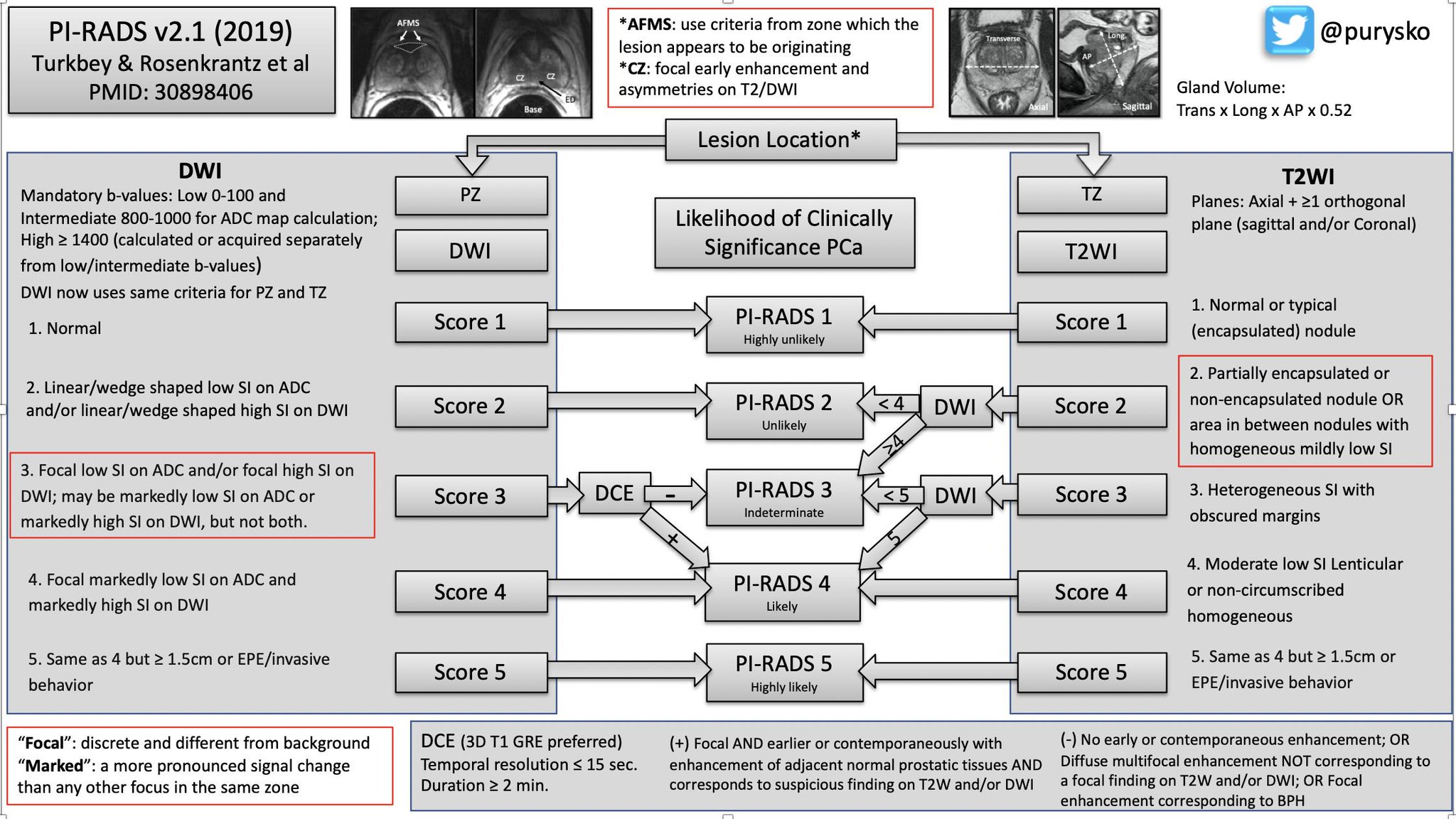 Pi rads 4. Периферическая зона предстательной железы на мрт. Pi rads 4. Pirads мрт. Pi-rads 3-4.