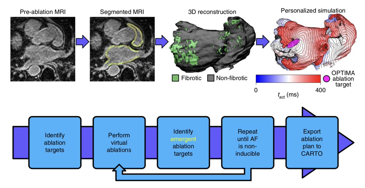 natBME's tweet photo. Computationally guided personalized targeted ablation of persistent atrial fibrillation
https://t.co/SASsoil8BT https://t.co/MIck428TXQ