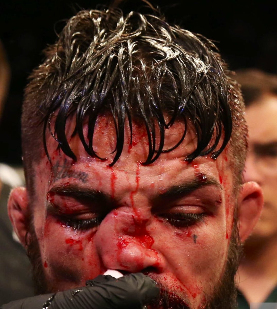 Mike Perry’s Nose👃 tweet media