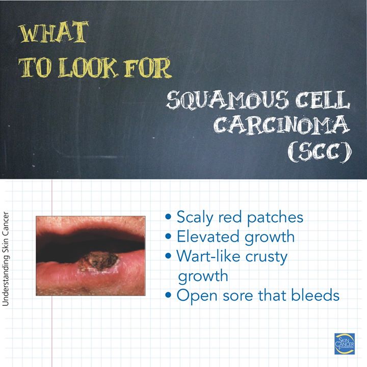 Treasure Valley Dermatology tweet media