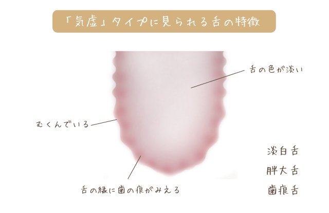 Cocokara中医学 気虚 タイプに見られる舌の特徴 淡白舌 舌の色が淡い 胖大舌 はんだいぜつ 舌がむくんでいる 歯痕舌 しこんぜつ むくんでいるため舌の縁に歯の跡が見える 鏡の前でチェック ๑ ㅂ و T Co En5hkzxgss