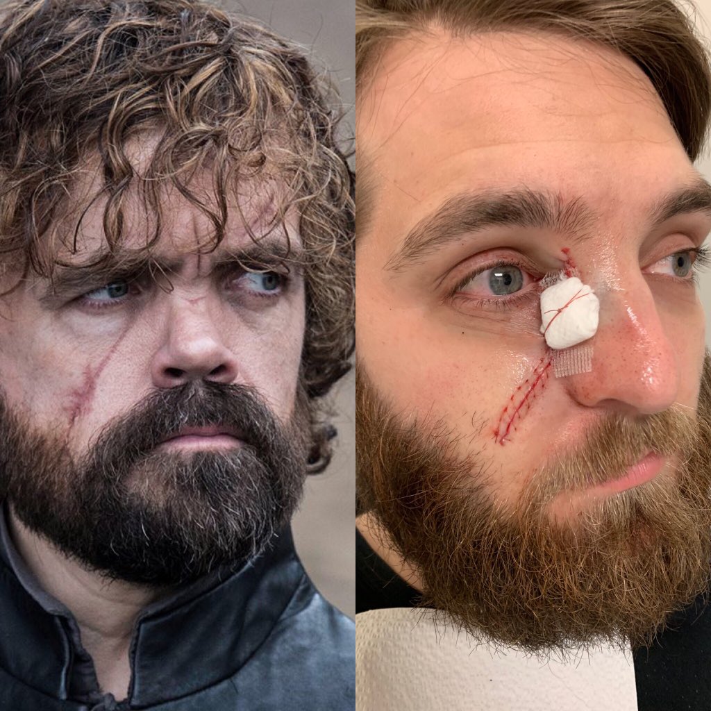 lolitalilu's tweet photo. @DunkinHOnutTV Who is who?  @GameOfThrones if y’all need a stand-in for #dinklebot, Ive got your man. #cantgetskincanceratthewall #hedrinksbutheknowsjackshit #caydedidntdieforthis @DestinyTheGame #ripcayde #getyourbrokeasseyeupguardian https://t.co/MhRzWz2lZz