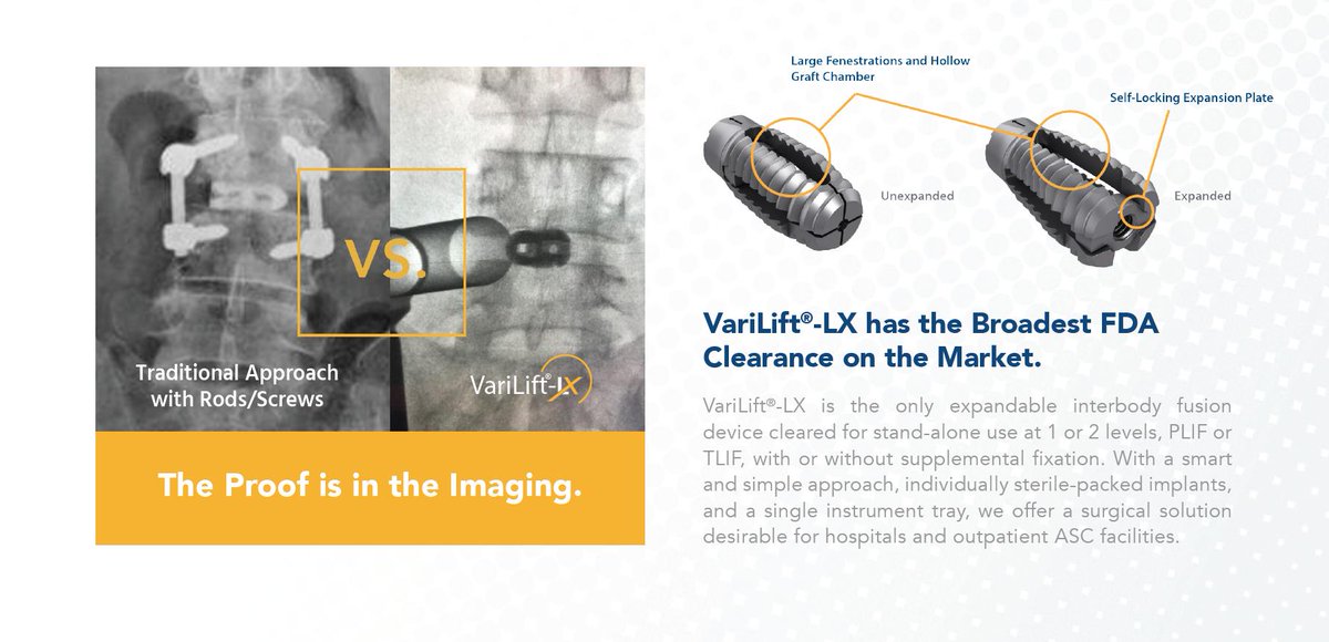 WenzelSpine's tweet photo. #simplifyspine #standalone #fusion #VariLift-LX #MIS #ASC https://t.co/FV4mZyXuiz