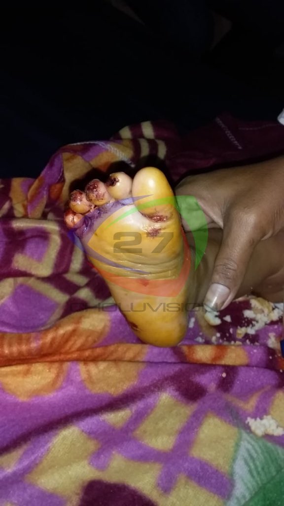 Choluvision27's tweet photo. Niña de 14 meses se quema los pies en una basura caliente en Cedeño, Marcovia.

Más detalles en CHOLUVISION CANAL 27

#Choluteca https://t.co/QM9YXPekjG