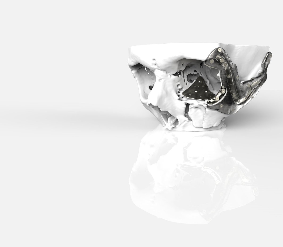 RenishawMedical's tweet image. We're attending the 29th Biennial Congress of The Institute of Maxillofacial Prosthetists and Technologists (@IMPT_news) in Swansea, 4th to 6th Sept 2019. 

Meet us in the exhibitors area! 

Find out more about the event here: impt.co.uk/forthcoming-ev… 
#IMPT2019 #3Dprinting