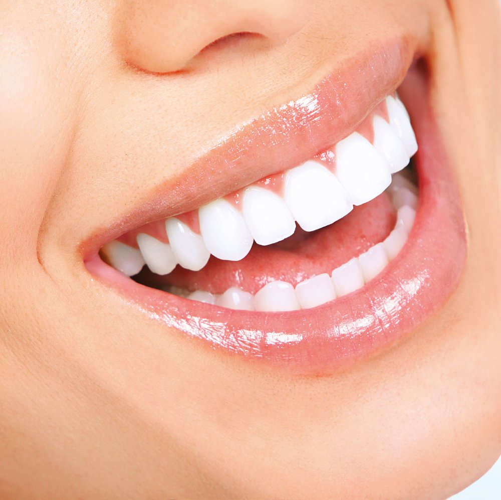 SmilessenceUK's tweet photo. Advanced power teeth whitening - Zoom - Up to six shades lighter £375.00 Book today - Offer ends 31st August - Check out https://t.co/0MWrPjKPQ4 for our offers.

#teethwhitening #zoom #sixshades #advanced https://t.co/kCEkOOm2Tp