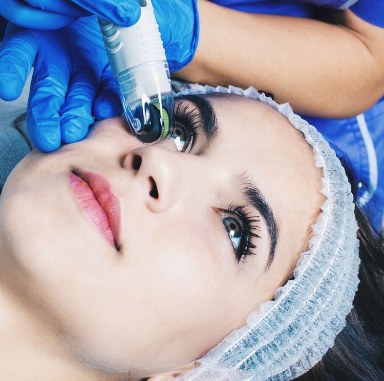 GenesisBio's tweet photo. DermaFrac™ is a customizable treatment! Practitioners can select 0.25mm or 0.5mm needle roller tips depending on the skin anomaly being targeted and the overall skin texture. Contact us for more!
📷: @newskinaustralia
#dermafrac #DermafracC #GenesisSkin #microneedling #infusion https://t.co/2pZD7XWYxu