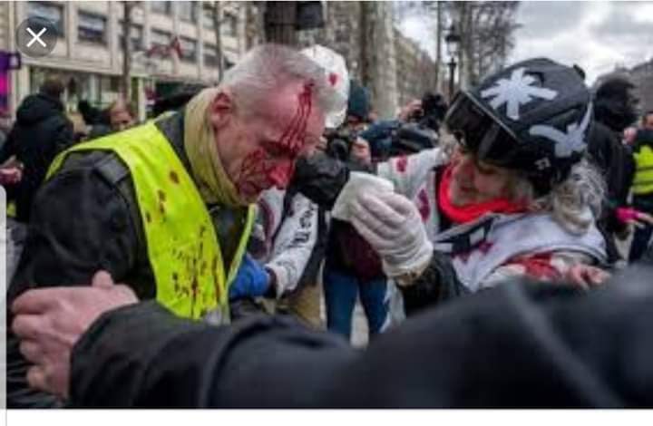 ThomasS77556668's tweet photo. The want Zimbabwe to transform yet in their own so called democratic nations they are failing to implement what they preach in Africa..
"pinky noses ....shut your mouths" R.G Mugabe @UKinZimbabwe @LeaveEUOfficial @usembassyharare @euinzim @cdebhana @Teechihuri @freemanchari https://t.co/nKzo9AMLsp