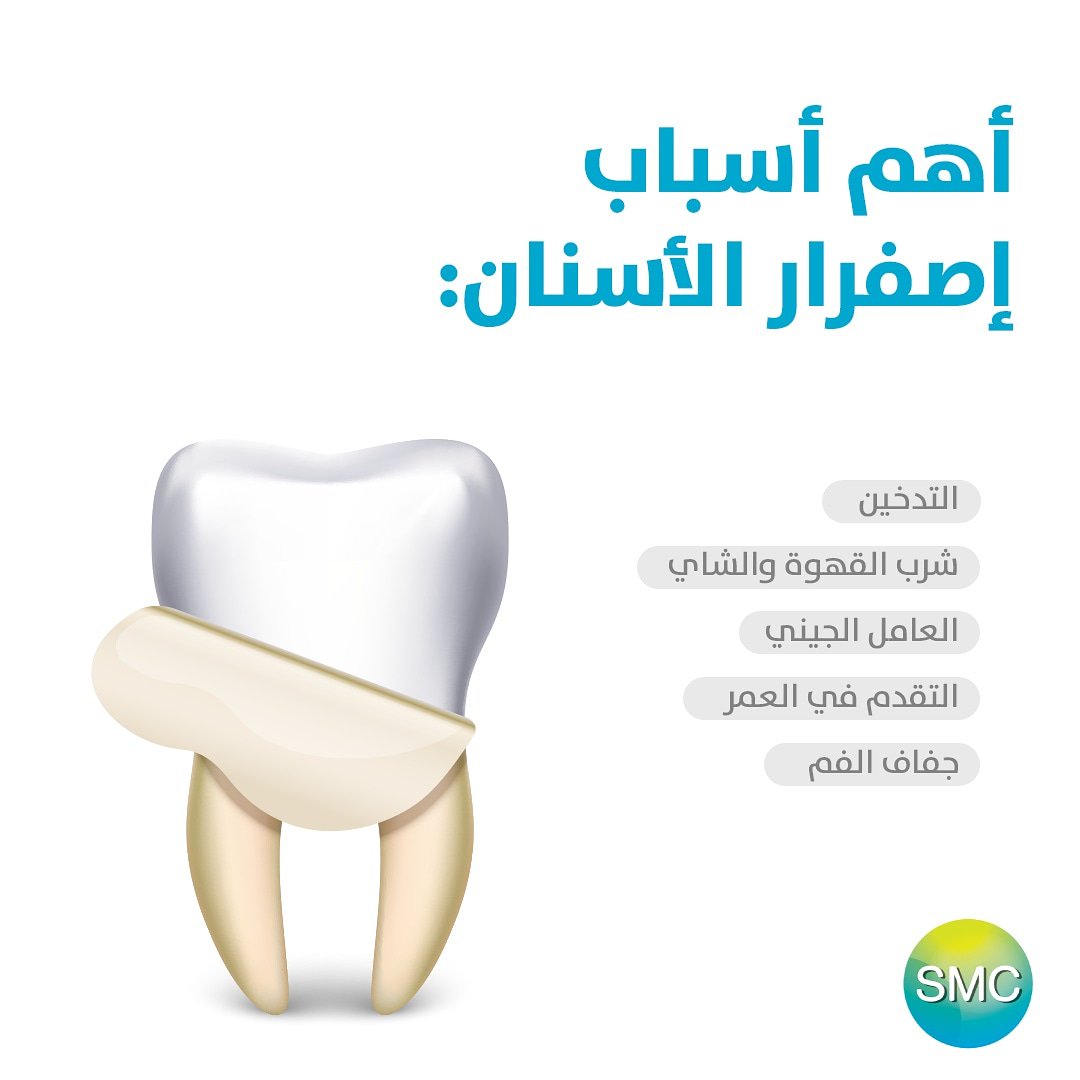 "لتجنب اصفرار الأسنان حافظوا على تنظيف أسنانكم بشكل يومي بالفرشاة والخيط، و
مراجعة طبيب الأسنان كل 6 أشهر لتنظيف أسنانك بشكل طبي وصحي."
"
#المركز_التخصصي_الطبي
#صحة #دواء #مستشفى #طب 
#health #healthy #fit #healthylife
#hospital #medicine #medical #SMC