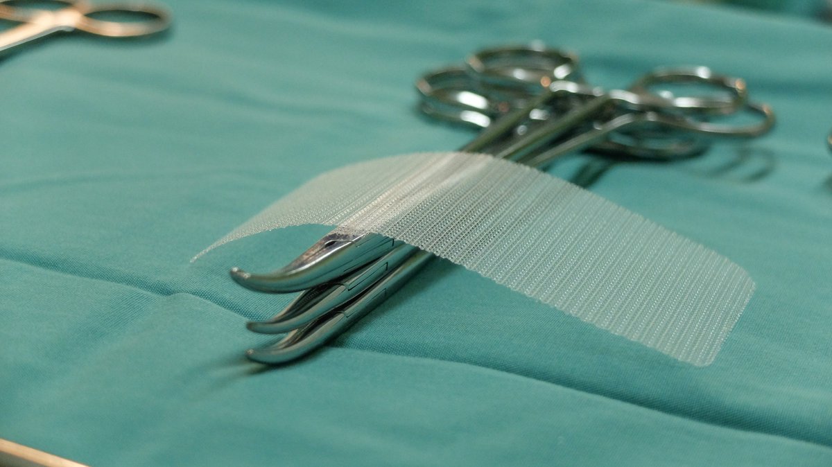 LernerandRowe's tweet image. Did you recently undergo a hernia surgery, then experience post-surgical complications caused by faulty surgical mesh? If so, you could be eligible to receive financial compensation. #surgicalmesh #compensation #dangerousproduct
lernerandrowe.com/dangerous-prod…