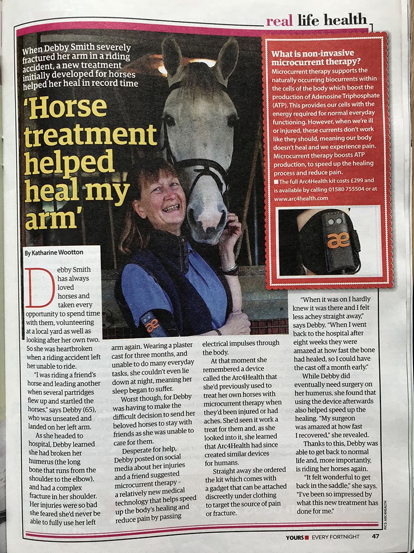 Arc4Health (@arc4_health) on Twitter photo "When I went back to the hospital after eight weeks they were amazed at how fast the bone had healed, so I could have the cast off a month early."
Have you read this incredible #recovery story in <a href="/yoursmagazine/">Yours magazine</a>
Thanks to #Arc4Health👍🏼 "When I went back to the hospital after eight weeks they were amazed at how fast the bone had healed, so I could have the cast off a month early."
Have you read this incredible #recovery story in <a href="/yoursmagazine/">Yours magazine</a>
Thanks to #Arc4Health👍🏼
