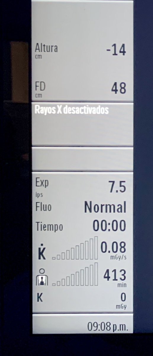 OscarVazquezEP's tweet photo. First (of many to come) #fluoroless ablation in my centre. One step closer to the #EPeeps milestone of fluoroless AFib ablation. #HRLALM #Mexico https://t.co/Q7sZsyW04k