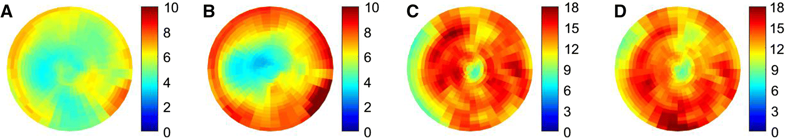 JNCjournal's tweet photo. #JournalNC: https://t.co/0Dcsfos1zN Multi-pinhole #SPECT images with less noise than standard SPECT, but uncertainty increases at #LV base  #CVNuc @HeartInstitute, @UOHIResearch, @CarletonMedPhys, @SCuddyWalsh  @MyASNC https://t.co/V5DFR7JHJX