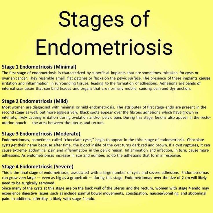 EndoNugget's tweet photo. #EndoNugget 
#EndoAwareness 
Please remember that there is no correlation between the stage you’re on and the pain you experience. https://t.co/Z3aRw5Qz2A