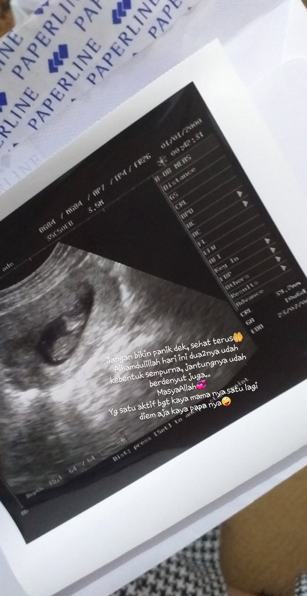 fridaidot's tweet photo. My baby twins💞 https://t.co/780Dfb9138