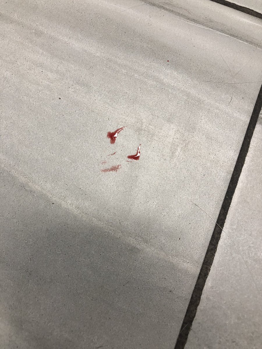 EveBatelle's tweet photo. Mommy was NOT excited to see Princess’ foot bleed. It seems she broke her nail while trying to get the big bad crow birds to leave her little Woodstock birdies alone. She is her mother’s fur-child! #panic #husky #mysnugglebug https://t.co/ZtFPFPphkr
